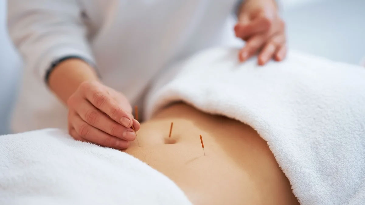 Miss V Tightening Acupuncture